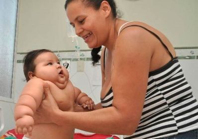 Bebê com 25 quilos luta para emagrecer